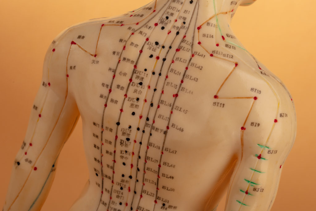 Image showing Acupuncture points that heal the body